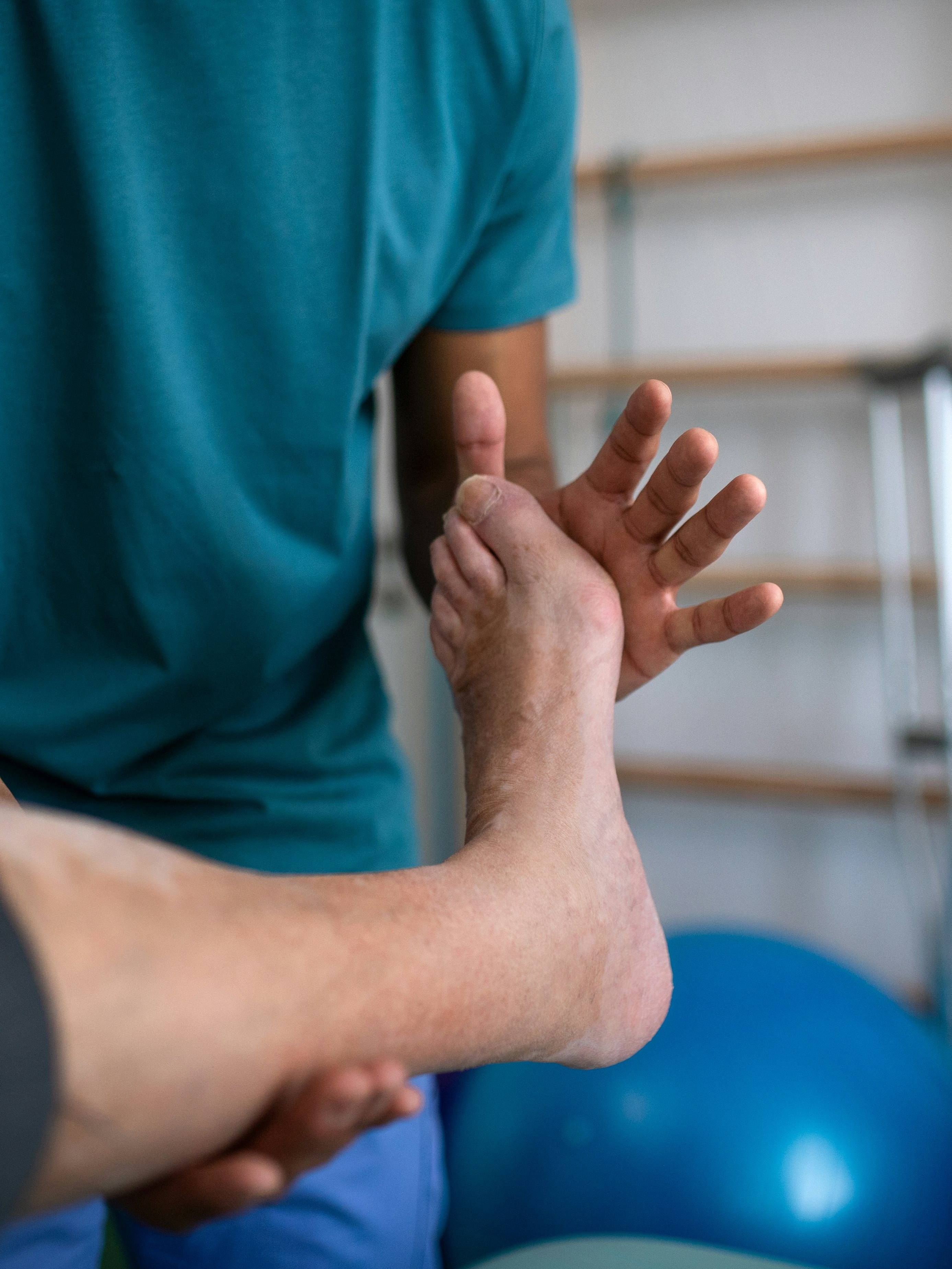 recuperación de tobillo